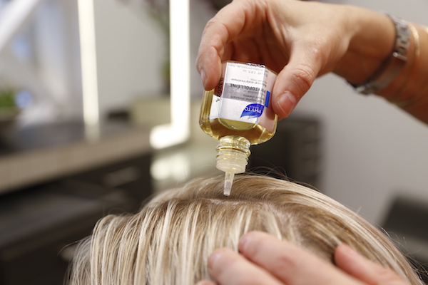 Everything You Need To Know Hair Thinning